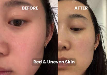 Matcha Mask Refill Bundle – 15 Masks