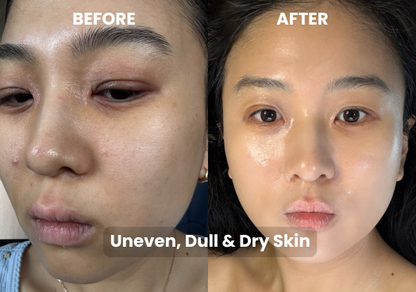 Matcha Mask Refill Bundle – 15 Masks