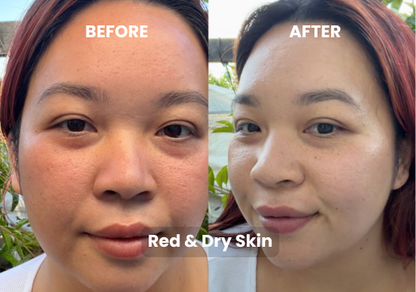 Matcha Mask Refill Bundle – 15 Masks